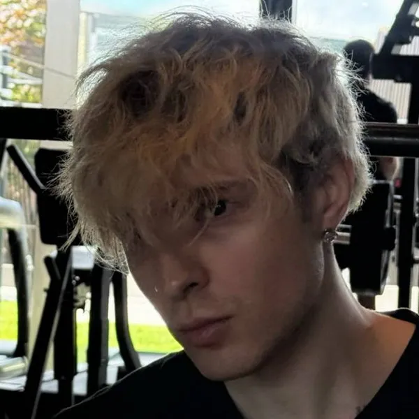 Егор Крид: серьезная травма ноги после падения